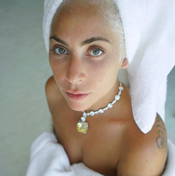 Lady Gaga miała wypadek! Zrobi przerwę od show-biznesu?