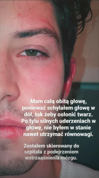Brutalne pobicie aktora z