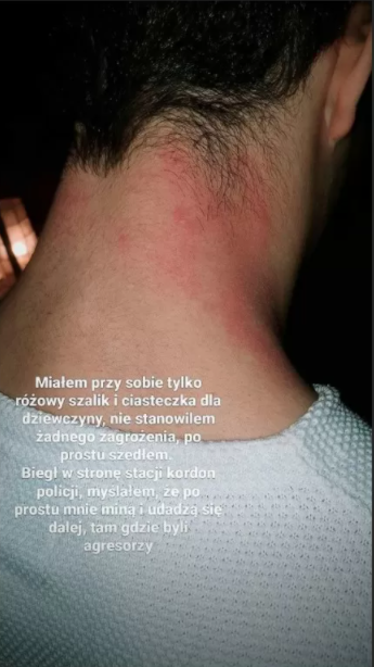 Brutalne pobicie aktora z