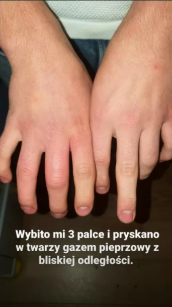 Brutalne pobicie aktora z