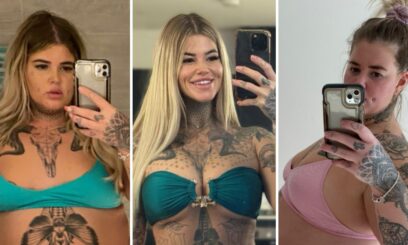 Operacje plastyczne.