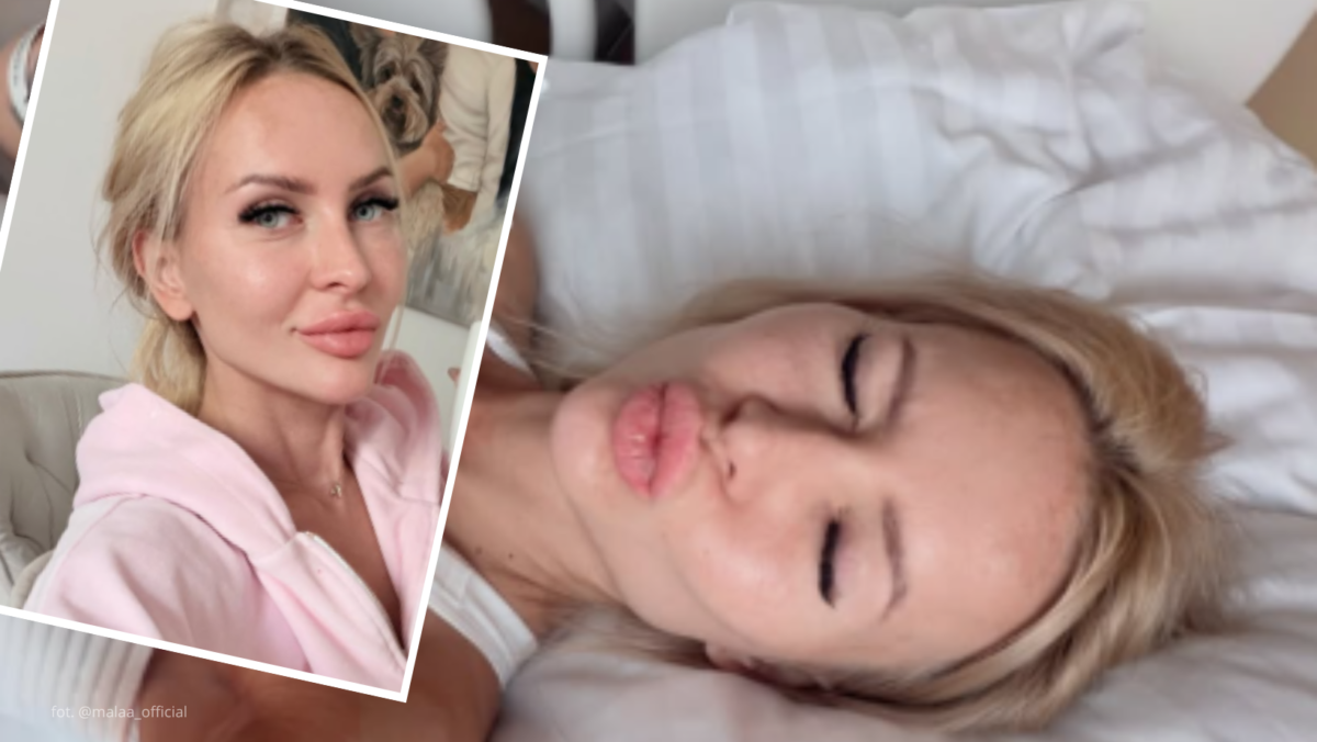 Mała Ania pokazała, jak wygląda po operacji piersi